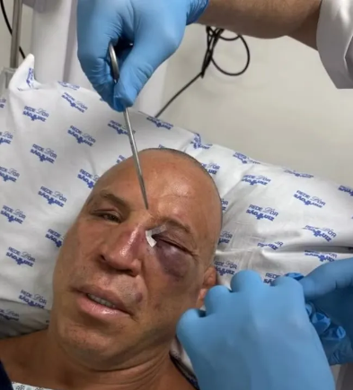 WANDERLEI PROCESSARÁ AGRESSOR POR TENTATIVA DE HOMICÍDIO, DIZ ADVOGADO