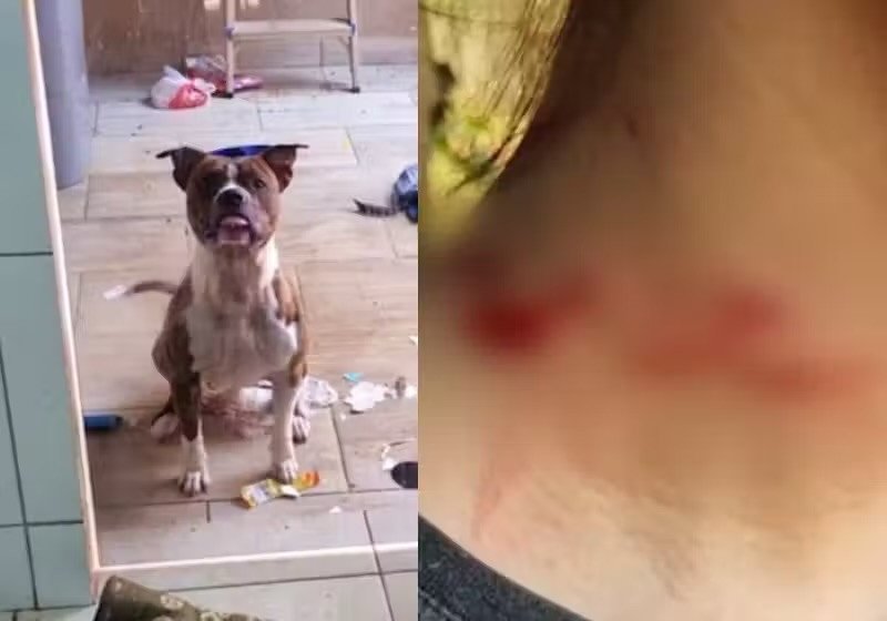 Pitbull herói avança e salva garota que foi atacada com faca pelo irmão
