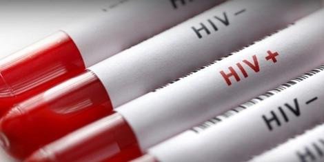 BOA NOTÍCIA: nova vacina contra o vírus HIV apresenta bons resultados