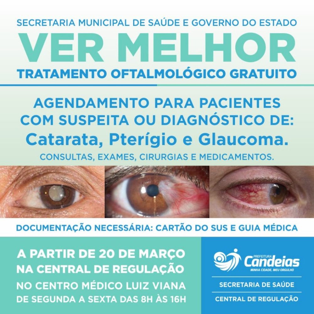 Prefeitura de Candeias realiza ação “Ver Melhor” para cuidado da visão