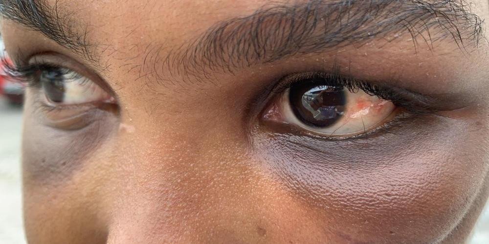 Polícia prende suspeito de manter namorada em cárcere privado em Camaçari