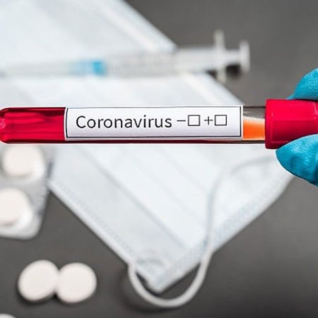 Coronavírus: Brasil tem 357 óbitos em 24h, são 3.670 mortes e 52.995 casos confirmados.