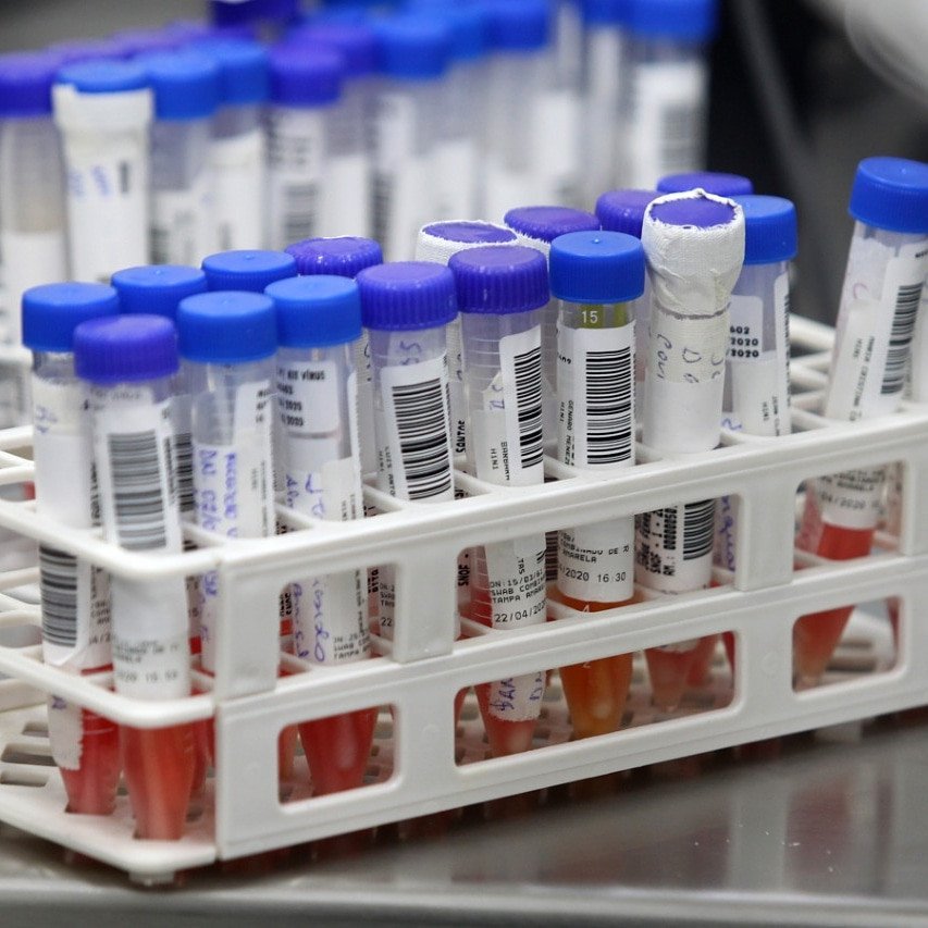 Covid-19: Vacina pode ficar pronta até setembro; dizem cientistas de Oxford