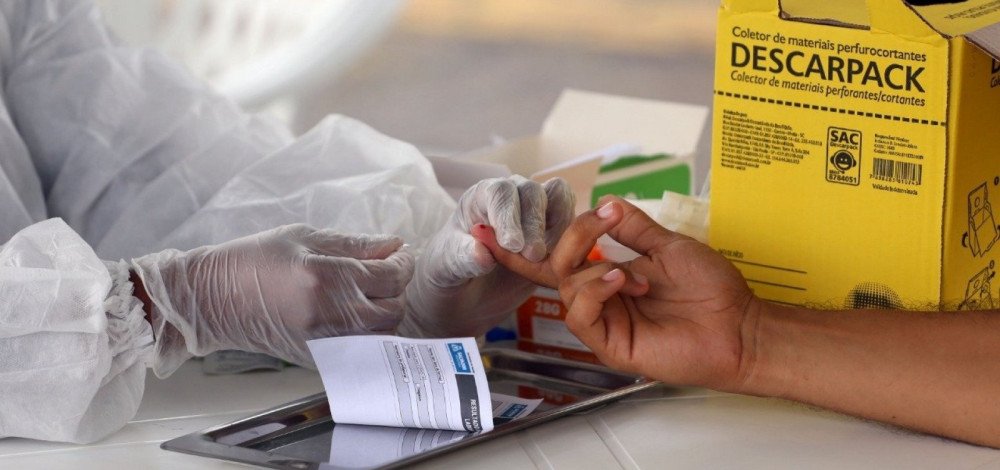 Após pressões, governo promete recuar e manter divulgação detalhada de dados da Covid-19