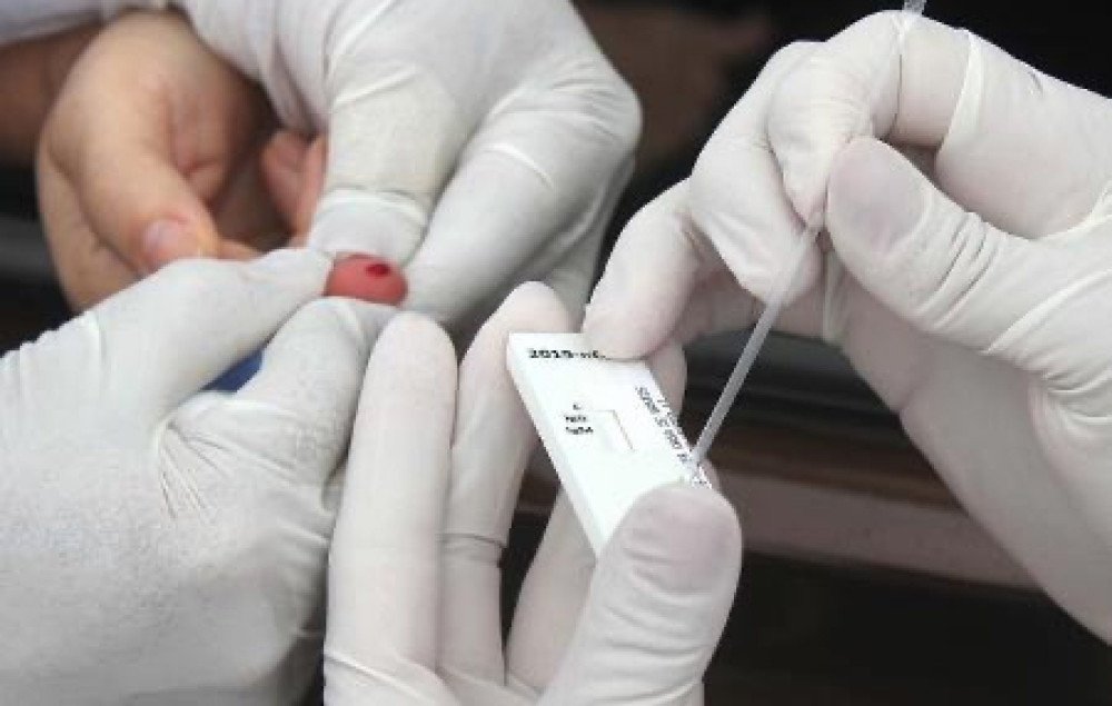 São Francisco do Conde tem índice de 63% de casos curados da COVID-19