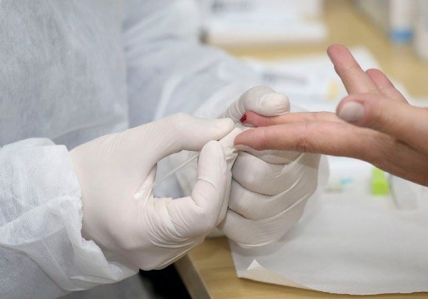 Brasil já possui 2,6 milhões de casos confirmados do coronavírus