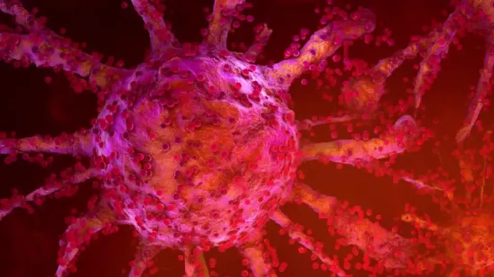 Terapia celular leva à remissão completa de câncer em paciente no SUS