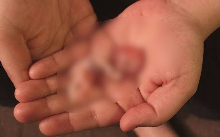 Feto é encontrado abandonado em via pública de Madre de Deus